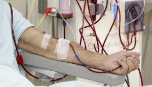 Hemodialysis Market Report 2023 | Industry Share, Size and Forecast 2028